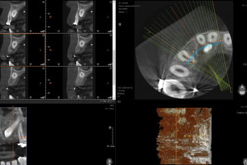 3D CBCT