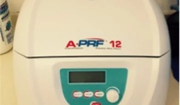 Uporaba lastne plazme – PRF (Platelet rich fibrin)