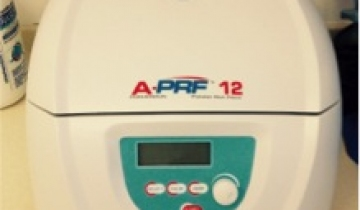 Uporaba lastne plazme – PRF (Platelet rich fibrin)